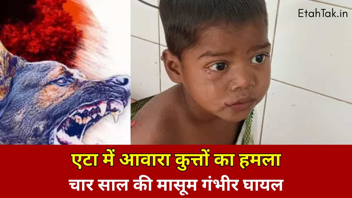 Etah News Dogs Attack