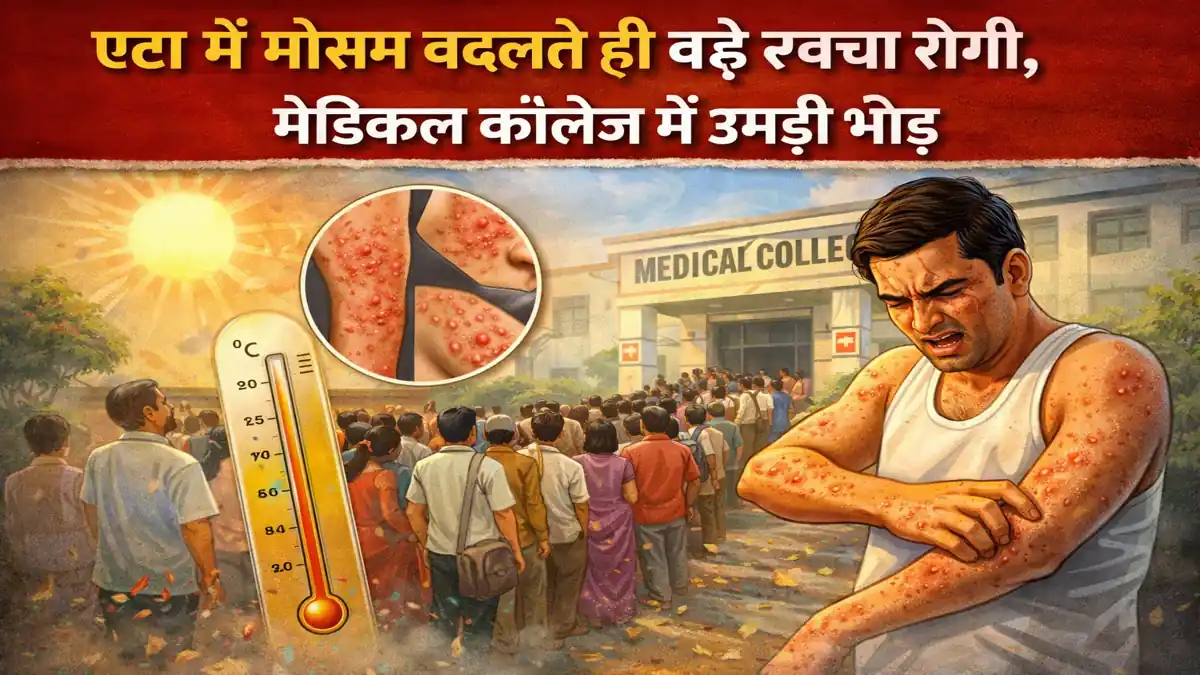 Etah me mausam badlte hi bade tvcha ke rogi