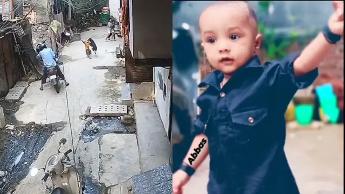 दिल्ली के संगम विहार में 18 मह के बच्चे पर आवारा कुत्ते का हमला